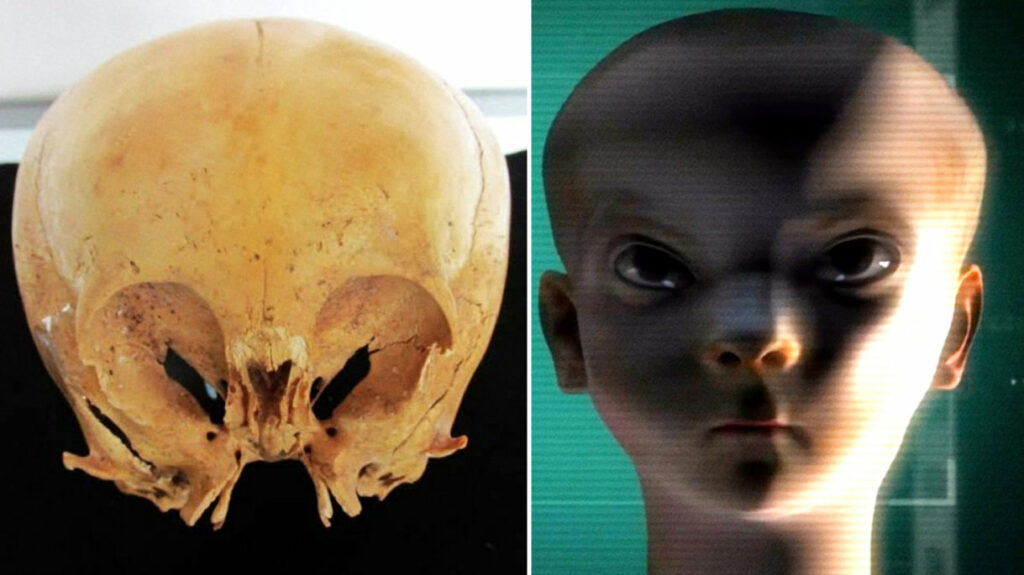 Starchild Skull: The mysterious origin of the Star Children 4