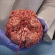 갓 제거된 인간의 뇌를 보여주는 이 비디오는 세계를 매료시켰습니다 5