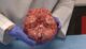 This video of a freshly removed human brain has fascinated the world 16