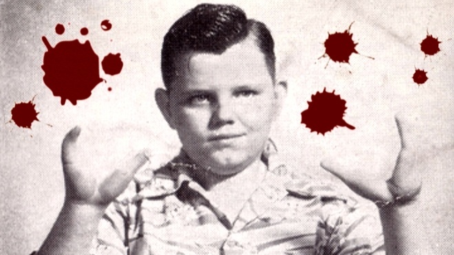 Grady Stiles – the 'Lobster Boy' who killed his family member 8
