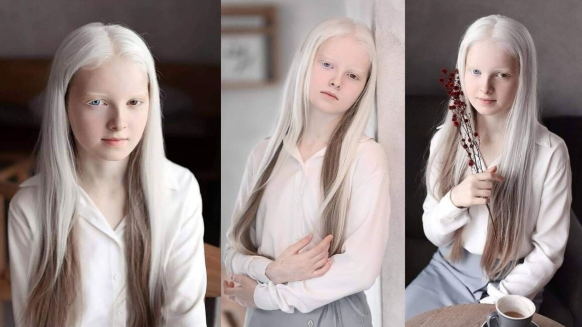 Amina Ependieva – 그녀의 특이한 아름다움으로 존경받는 체첸 소녀 8
