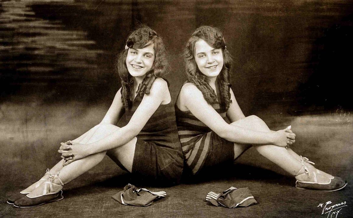 Daisy and Violet Hilton, conjoined twins