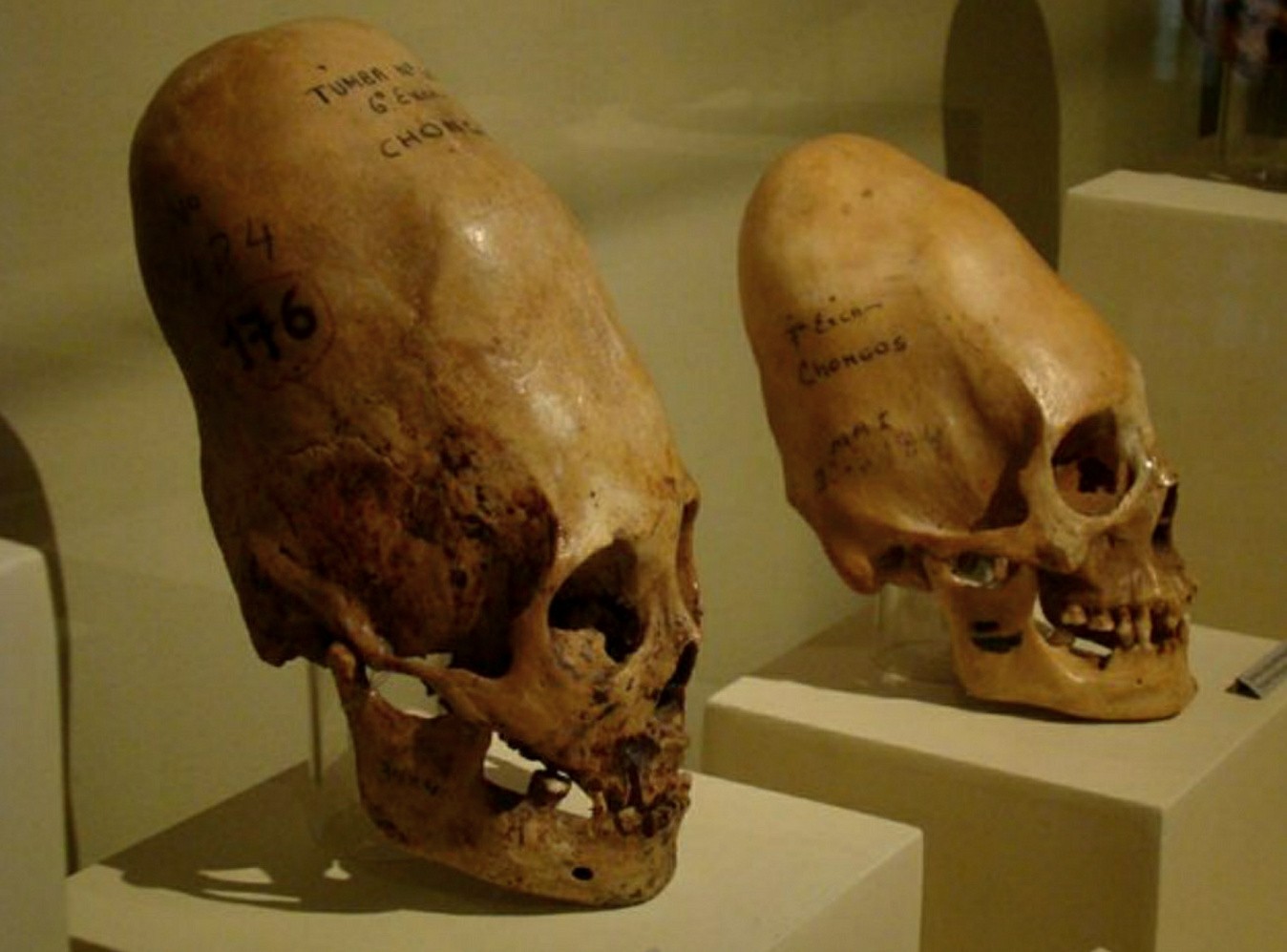 Paracas koponyák