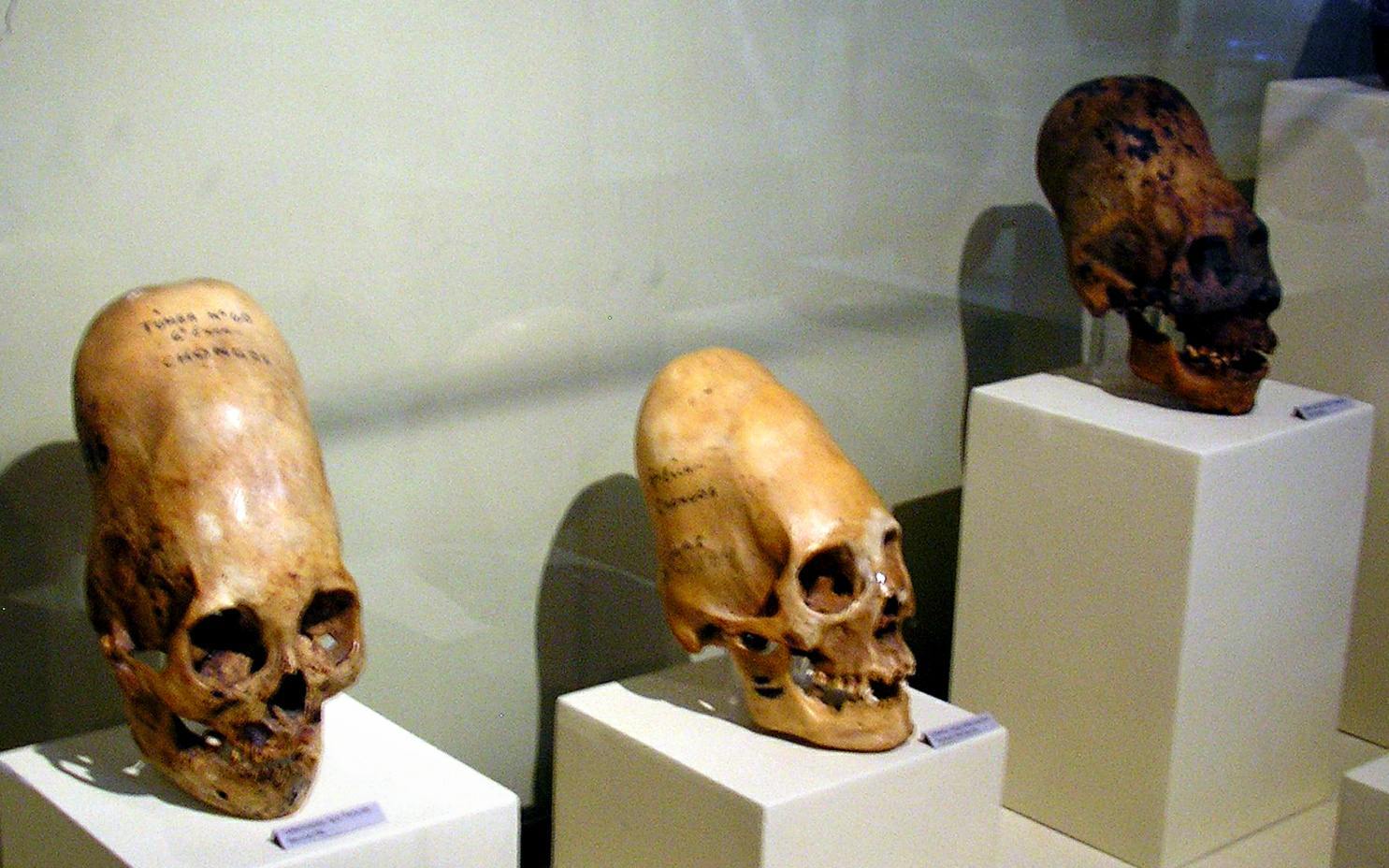 Ama-Paracas Skulls