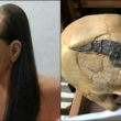 2,000-летний череп, скрепленный металлом