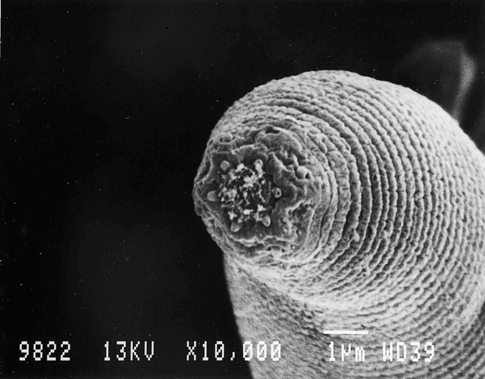 De Kapp vun der neier Nematode Halicephalobus mephisto. IMAGE COURTESY GAETAN BORGONIE, UNIVERSITY GENT