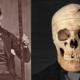 Phineas Gage: The man who lived after his brain was impaled with an iron rod! 10