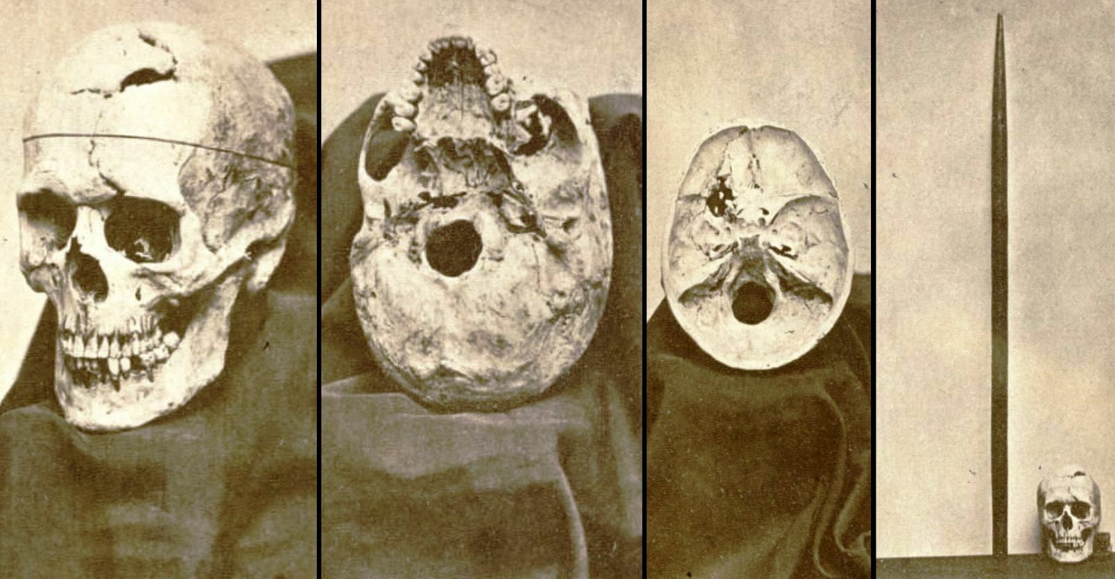 Gage's brother-in-law (a San Fran­cis­co city offi­cial) and his fam­i­ly per­son­al­ly de­liv­ered Gage's skull and iron to Harlow.
