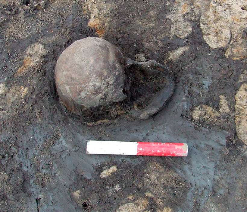 Heslington Brain: This strange ancient human brain was well-preserved for 2,600 years 1