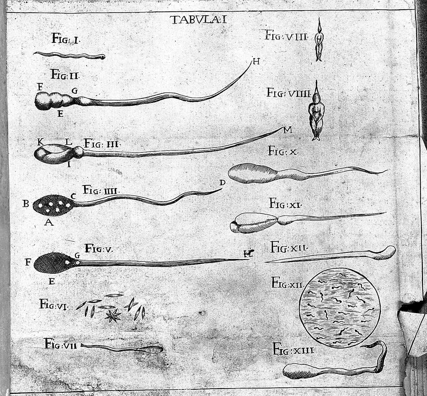 Figures of homunculi in semen.