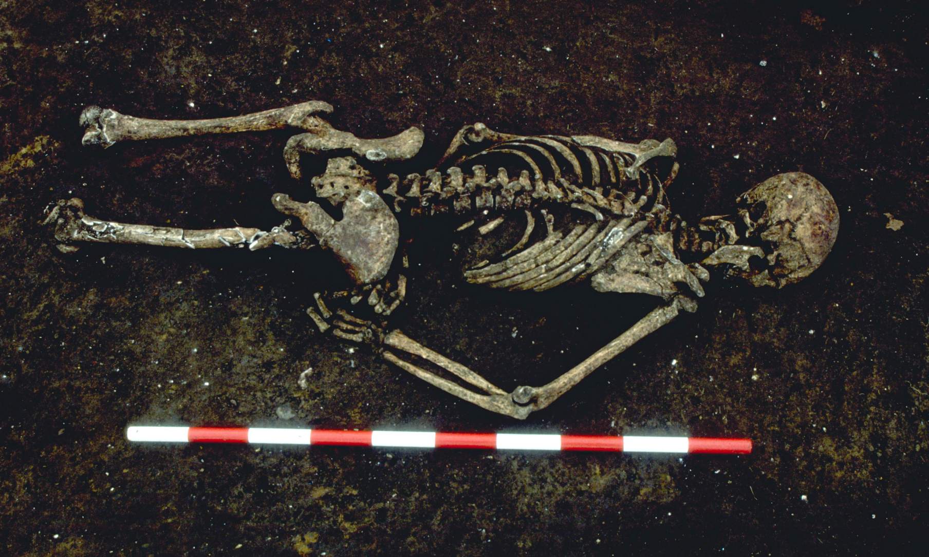 发现这具 1,500 年前的骨架面朝下，右臂弯曲成一个不寻常的角度。 研究人员说，他死时可能被绑起来。 他的下半身被现代的发展所摧毁。