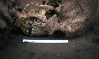 Mannens skelett hittades med en platt sten i munnen och en ny studie pekar på att hans tunga kan ha amputerats när mannen levde.