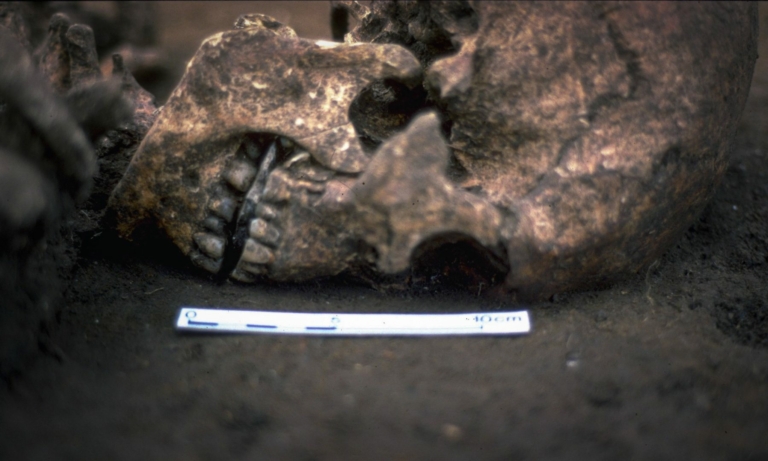 The man's skeleton was found with a flat stone in his mouth, and a new study indicates that his tongue may have been amputated when the man was alive.
