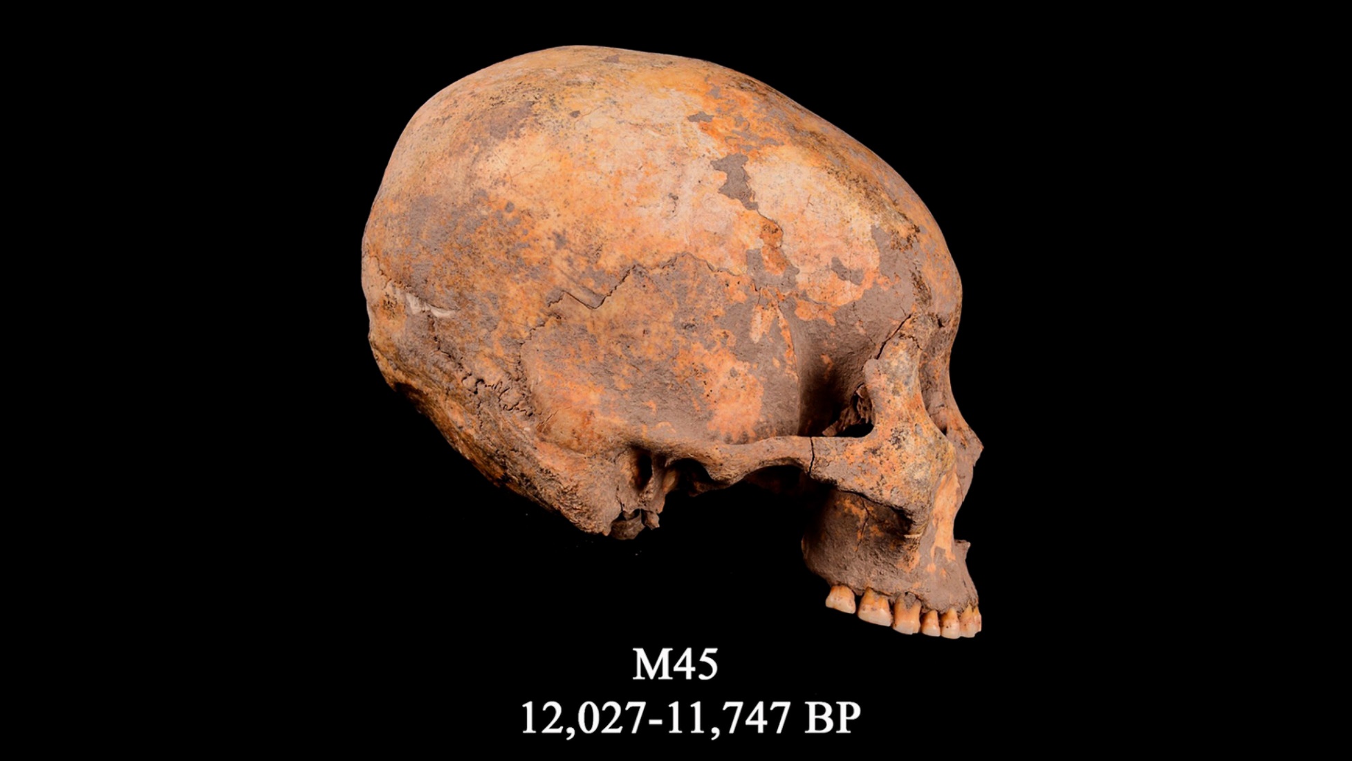 O crânio conhecido como M45, o mais antigo caso conhecido de modificação da cabeça registrado. Data de cerca de 12,000 anos atrás.
