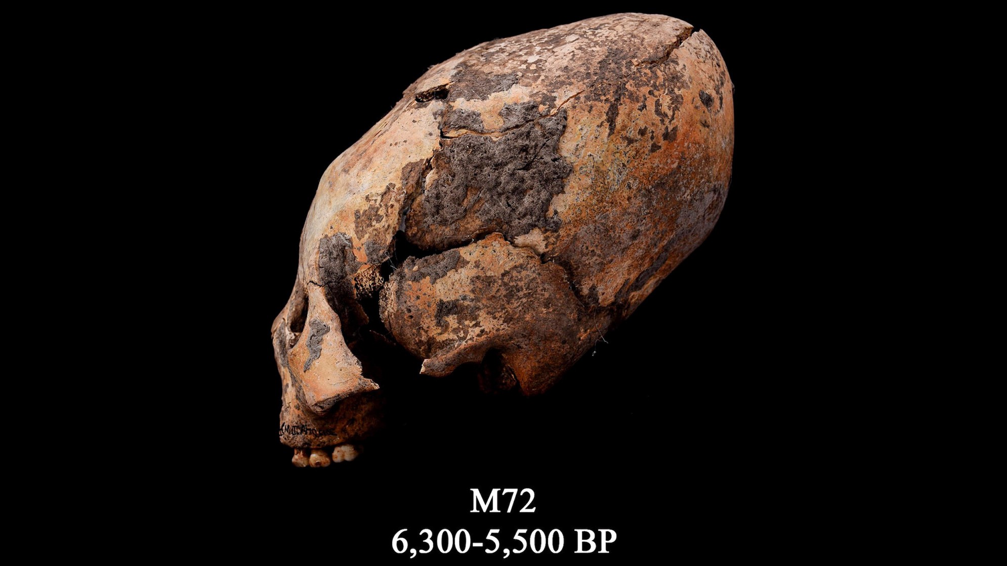 Lebka známá jako M72. Tato přetvořená lidská lebka byla nalezena v severovýchodní Číně a byla záměrně upravena