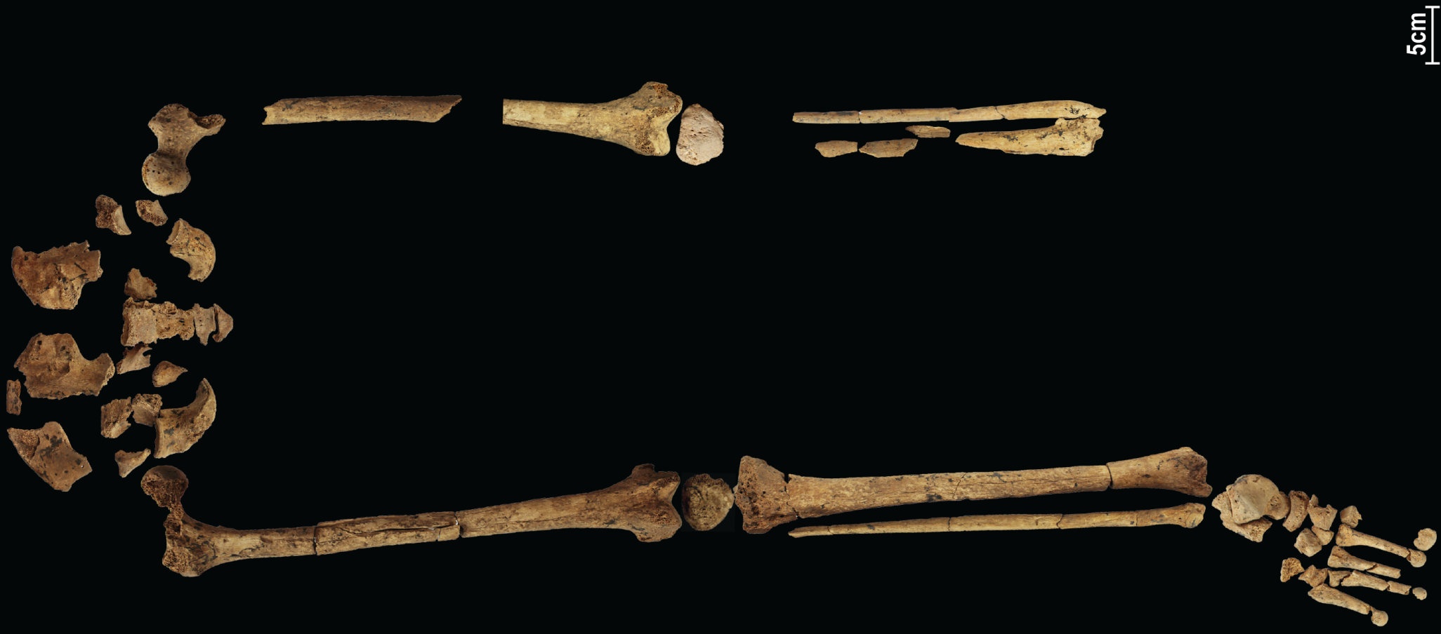 A 31,000-year-old skeleton showing the earliest known complex surgery could rewrite history! 4