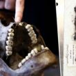 Il mistero di due secoli dei resti scheletrici di Waterloo 8