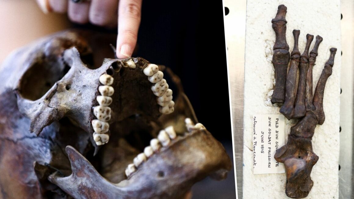 Dviejų šimtmečių senumo Vaterlo skeleto liekanų paslaptis 5