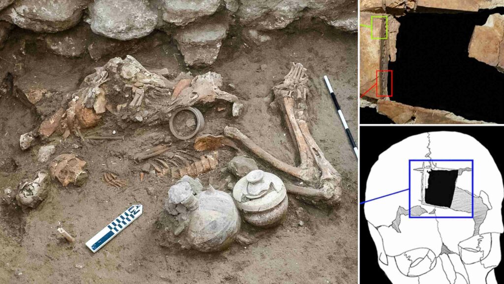 고고학자들은 후기 청동기 시대 6에서 뇌 수술의 초기 흔적을 발견