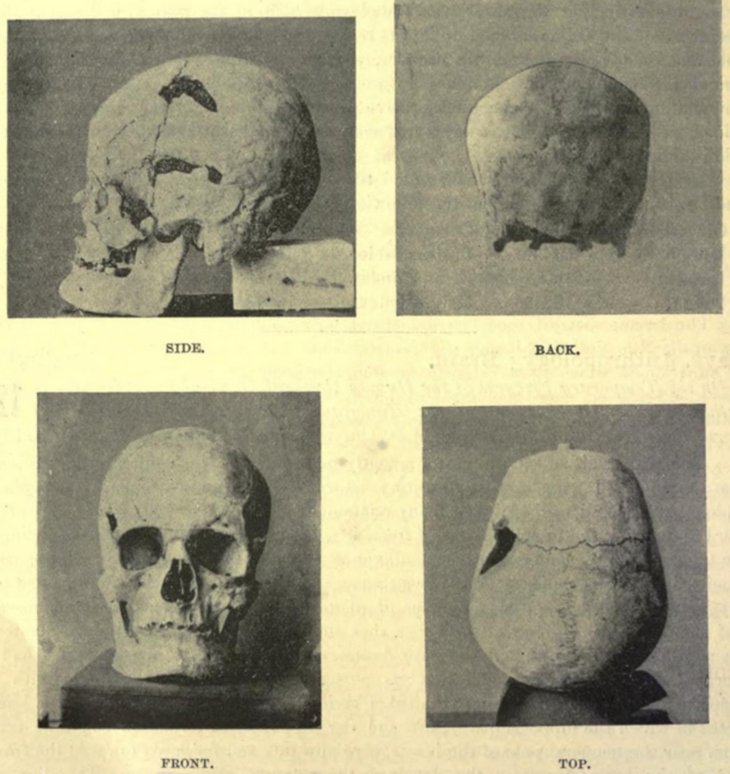 The possible skull of ancient Egyptian pharaoh Sanakht of the Third Dynasty.