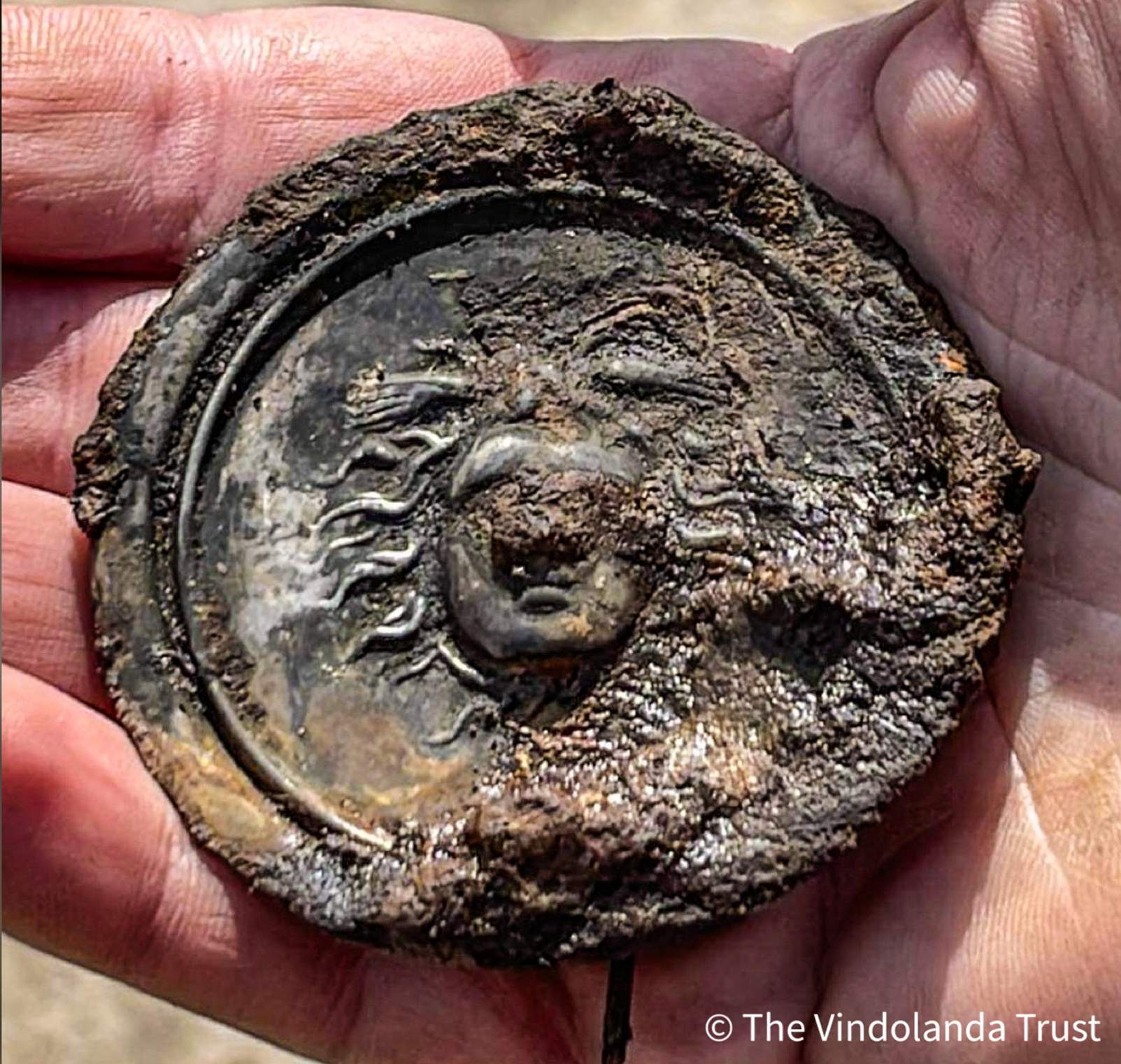 The hand-size Medusa medal dates to the Hadrianic period at Vindolanda, a Roman auxiliary fort in England.