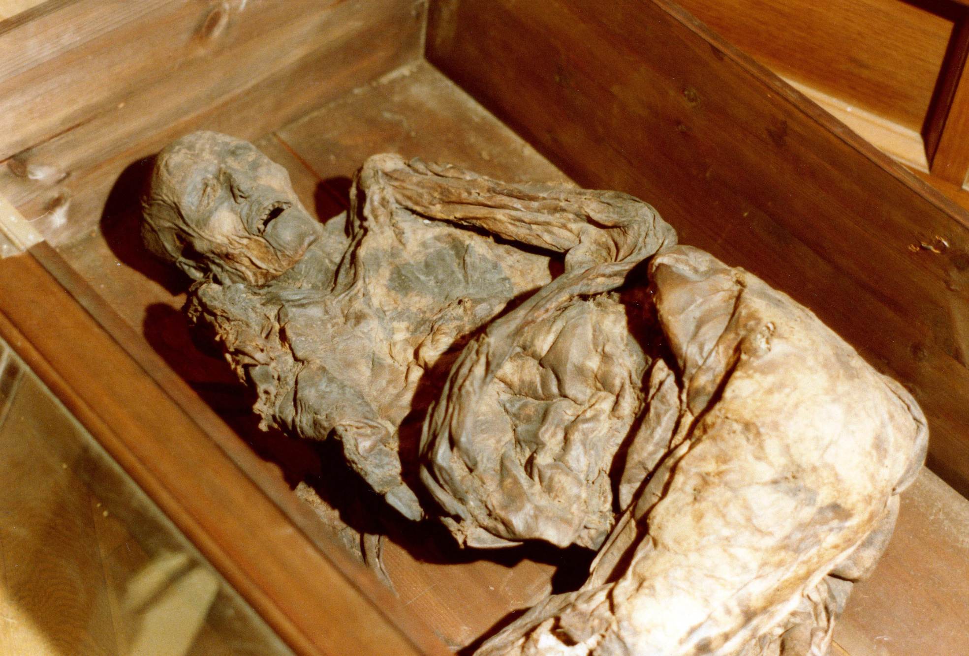 Bog body of the Huldremose woman