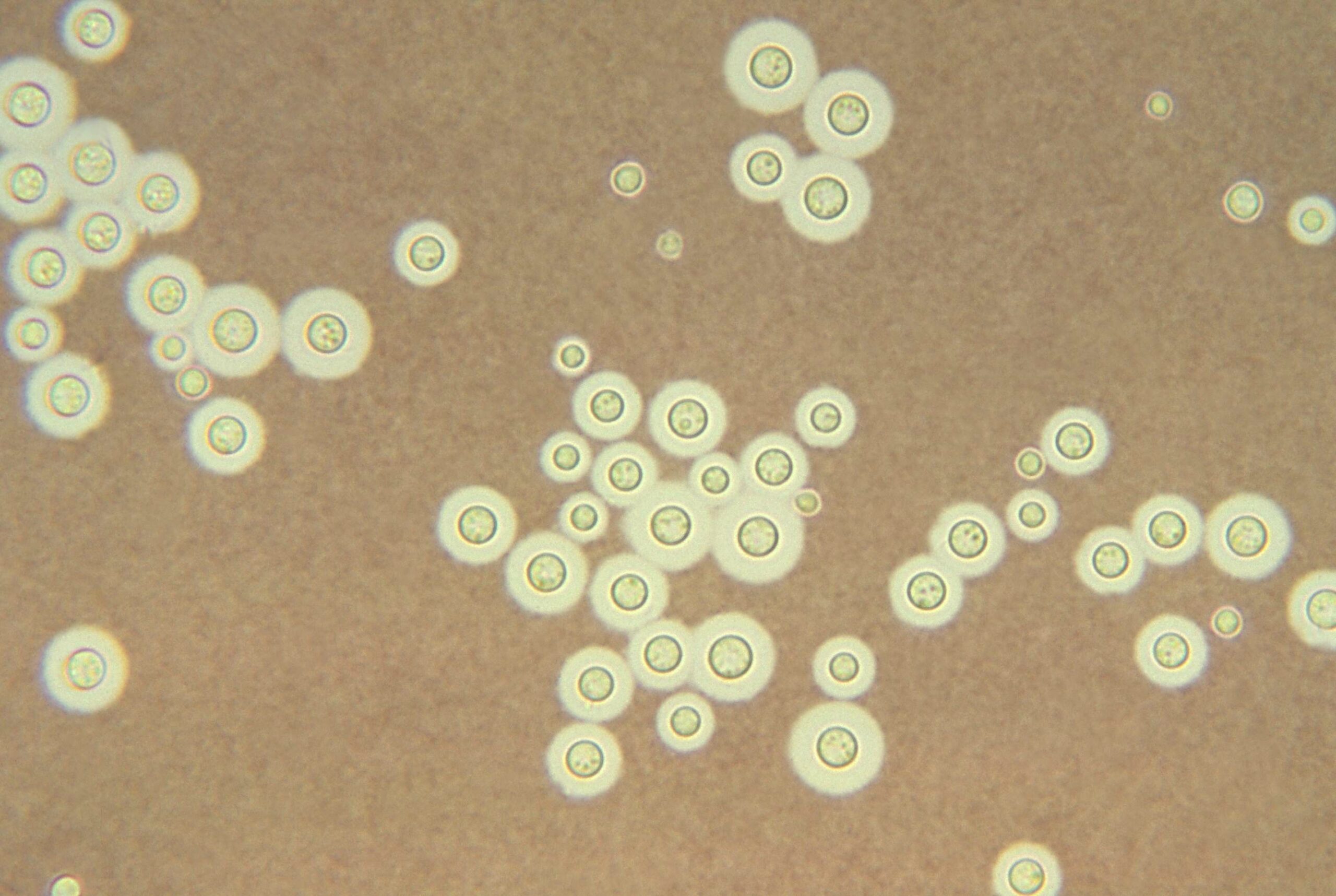 Hongos de Chernóbil Cryptococcus neoformans